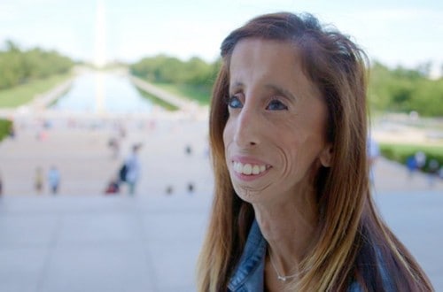 Lizzie Velasquez: They Called Me The World’s Ugliest Woman