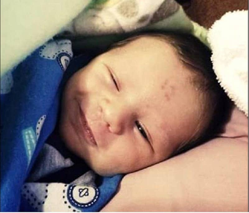 This Little Boy Was Born With An Unusual ’12’ Birthmark On His Forehead