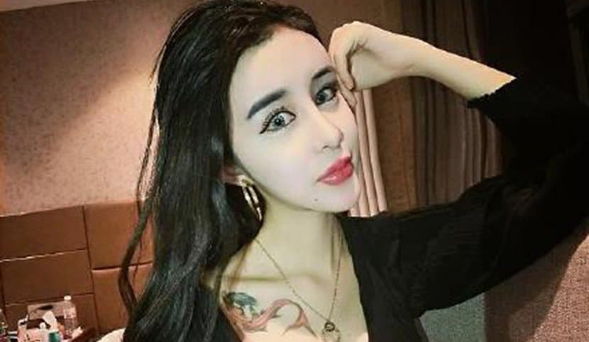 15-Year-Old Girl Attempts To Win Back Her Ex-Boyfriend Through Plastic Surgery