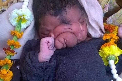 Indian Girl Born With Trunk Is Worshiped As Hindu God