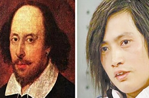 Man Spends £151,000 On Operations To Look Like William Shakespeare