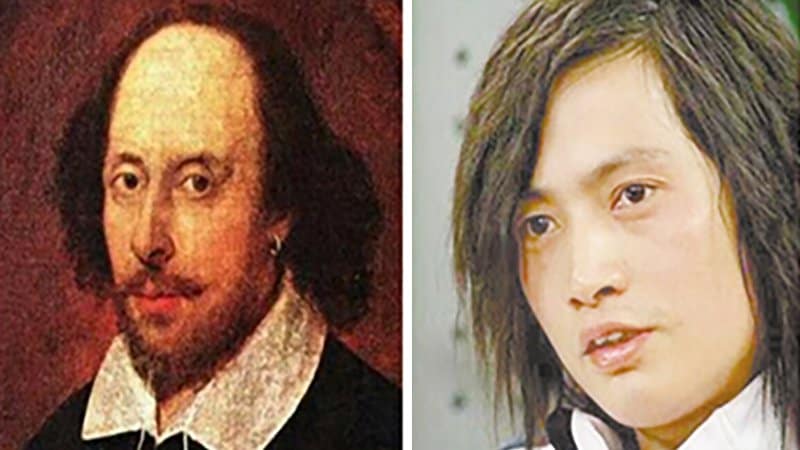 Man Spends £151,000 On Operations To Look Like William Shakespeare