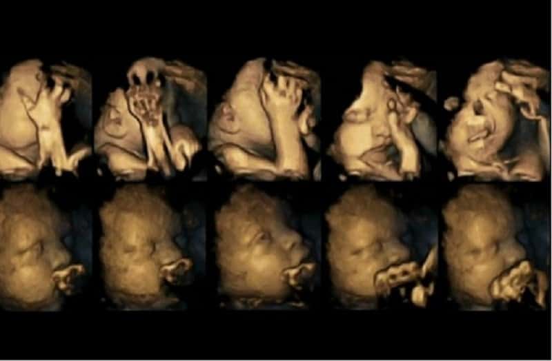 New 4D Ultrasound Scans Reveal The Effects Of Smoking During Pregnancy