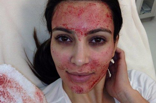 15 Cool, Crazy And Super Expensive Celebrity Beauty Treatments