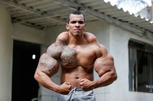 This Man’s Goal Of Looking Like The Hulk Almost Cost Him His Arms