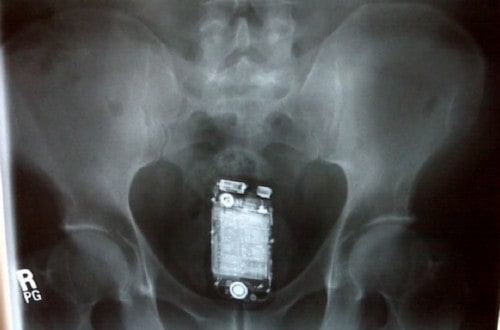 10 Incredible X-Rays That You Won’t Believe Are Real