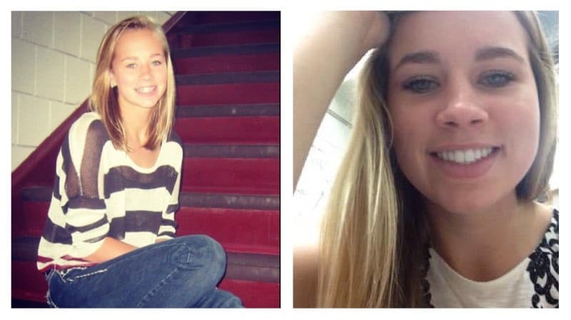 Teenage Girl Dies After Getting Wisdom Teeth Removed