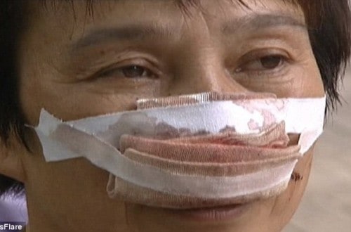 Husband Bites His Wife’s Nose Off And Then Eats It