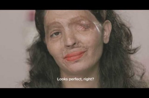 Shocking Makeup Tutorial Featuring Acid Attack Victim