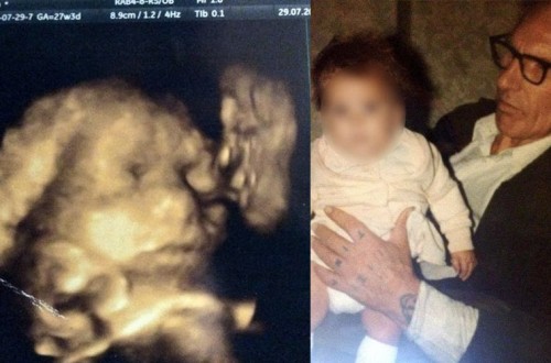 Mom-To-Be Sees Her Late Grandfather Kissing Her Unborn Baby In Ultrasound Scan