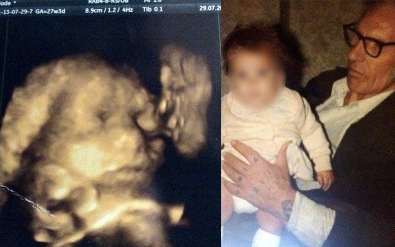 Mom-To-Be Sees Her Late Grandfather Kissing Her Unborn Baby In Ultrasound Scan