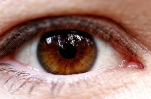 10 Of The Most Common Eye Problems In The World