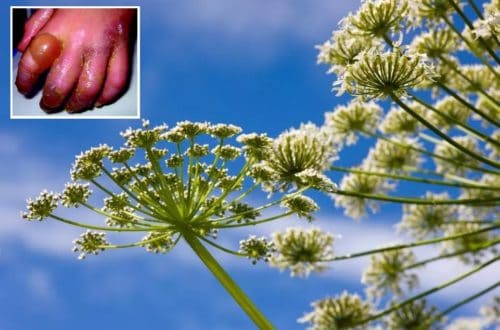 Plant That Causes 3rd Degree Burns And Permanent Blindness Found In Virginia
